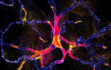 Neurodegeneration