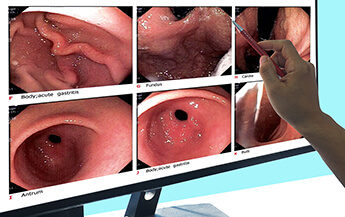 Close up Report of Gastrointestinal Endoscopy