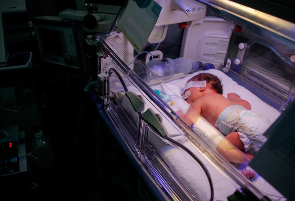 Premature little baby in an incubator at the neonatal section of the maternity