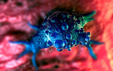 bladder cancer cells