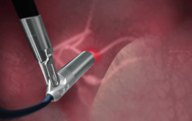 Lightpoint Medical, miniaturised cancer detection tools for robot-assisted surgery
