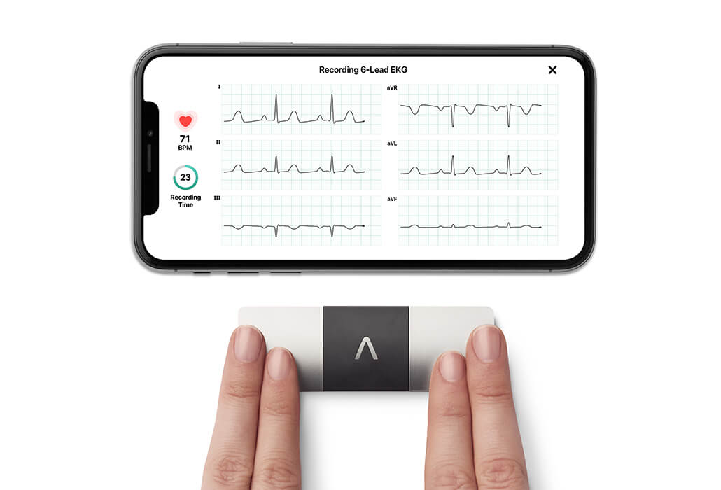 KardiaMobile 6L by AliveCor – the world's only six-lead personal ECG device